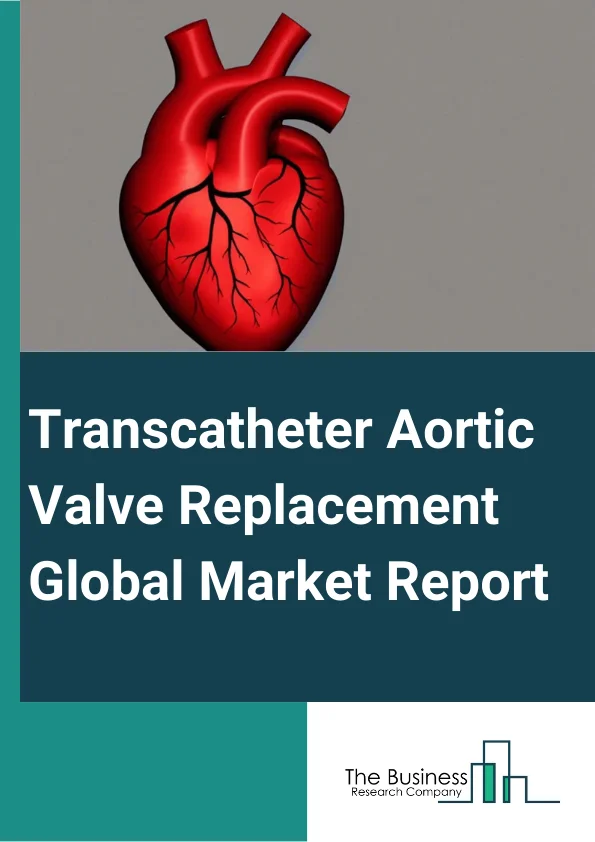 Transcatheter Aortic Valve Replacement