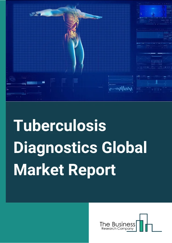 Tuberculosis Diagnostics Global Market Report 2025 – By Test Type (Radiographic Tests, Nucleic Acid Testing, Cytokine Detection Tests, Drug Resistance Tests, Skin Test / Mantoux Test (TST), Blood/Serology Test, Smear Microscopy Tests, Cell Culture-Based Tests, Other Test Types), By Disease Stage (Latent Tuberculosis, Active Tuberculosis), By End-User (Hospitals And Diagnostic Laboratories, Physician’s Office Laboratories, Reference Laboratories, Academics And Research Facilities) – Impact of Tariff and Trade War on Market Size, Growth, Trends, and Forecast 2025–2034