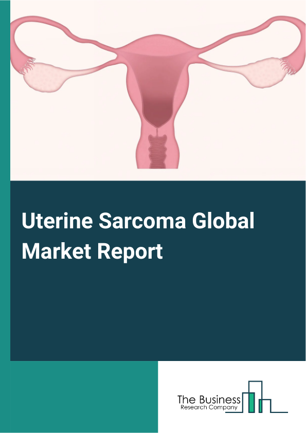 Uterine Sarcoma