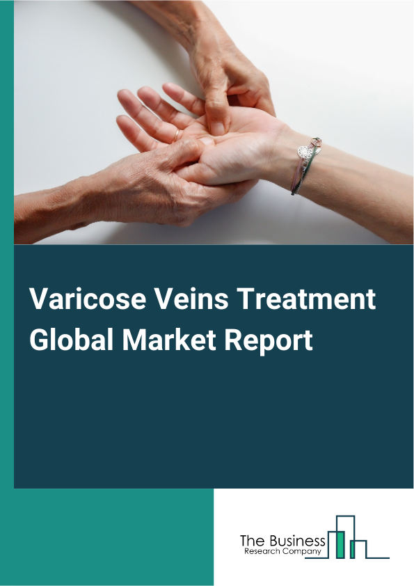 Varicose Veins Treatment