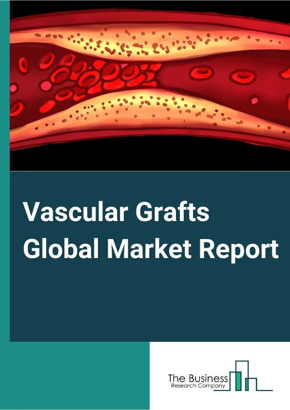 Vascular Grafts Global Market Report 2024 – By Product (Hemodialysis Access Graft, Endovascular Stent Graft, Peripheral Vascular Graft, Coronary Artery By-pass Graft), By Raw Material (Polyester Grafts, Polytetrafluoroethylene Grafts, Polyurethane Grafts, Biosynthetic Grafts), By Application (Coronary Artery Disease, Aneurysm, Vascular Occlusion, Renal Failure), By End-User (Hospitals, Ambulatory Surgical Centers) – Market Size, Trends, And Global Forecast 2024-2033