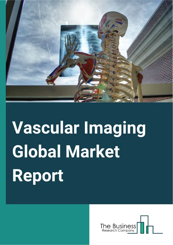 Vascular Imaging Global Market Report 2024 – By Technique (Magnetic Resonance Imaging, Ultrasound, Computed Tomography, Nuclear Imaging, X-Ray), By Procedure (Coronary Angiography, Peripheral Angiography, Neurovascular Angiography, Vascular Ultrasound Procedures, Micro Angiography, Other Procedures), By Application (Diagnostic Applications, Therapeutic Applications), By End User (Hospitals, Diagnostic Imaging Centers, Other End-Users) – Market Size, Trends, And Global Forecast 2024-2033