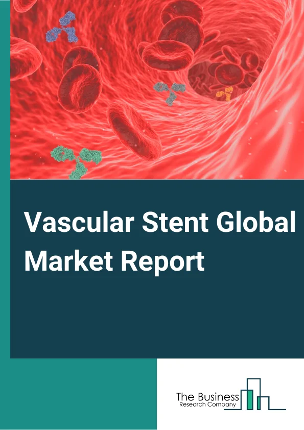 Vascular Stent Global Market Report 2025 – By Product( Coronary Stents, Peripheral Vascular Stents, Ever Stent Grafts), By Type( Bare Metal Stent, Bio-engineered Stent, Bioresorbable Vascular Scaffold, Drug Eluting Stent, Dual Therapy Stent), By Material( Metallic Stents, Cobalt-Chromium, Platinum Chromium, Nickel Titanium, Stainless Steel, Polymers Stents ), By Mode of Delivery( Balloon-expandable Stent, Self-expanding Stent), By End-user( Ambulatory Surgical Center, Cardiac Center, Hospital ) – Market Size, Trends, And Global Forecast 2025-2034