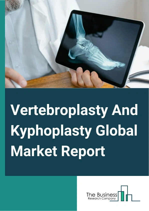 Vertebroplasty And Kyphoplasty Global Market Report 2025 – By Product Type (Kyphoplasty Devices, Vertebroplasty Devices), By Surgery Type (Vertebroplastic Surgery, Kyphoplastic Surgery), By End User (Hospitals, Ambulator...