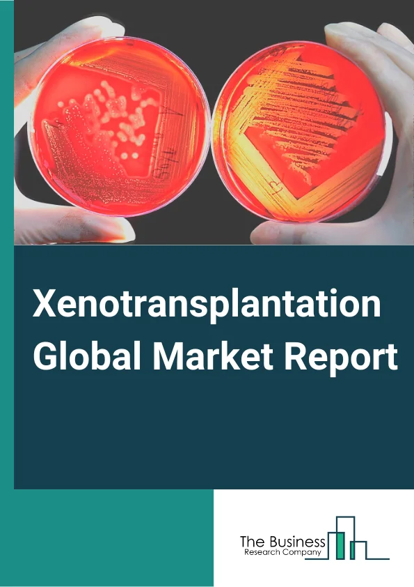 Xenotransplantation Global Market Report 2024 – By Products (Organ Preservation Solutions, Transplant Diagnostics, Tissue Products), By Treatment (Analgesic, Immunosuppressant, Other Treatments), By Applications (Heart, Kidney, Other Organs), By End-Users (Hospitals, Transplant Centers, Other End-Users) – Market Size, Trends, And Global Forecast 2024-2033