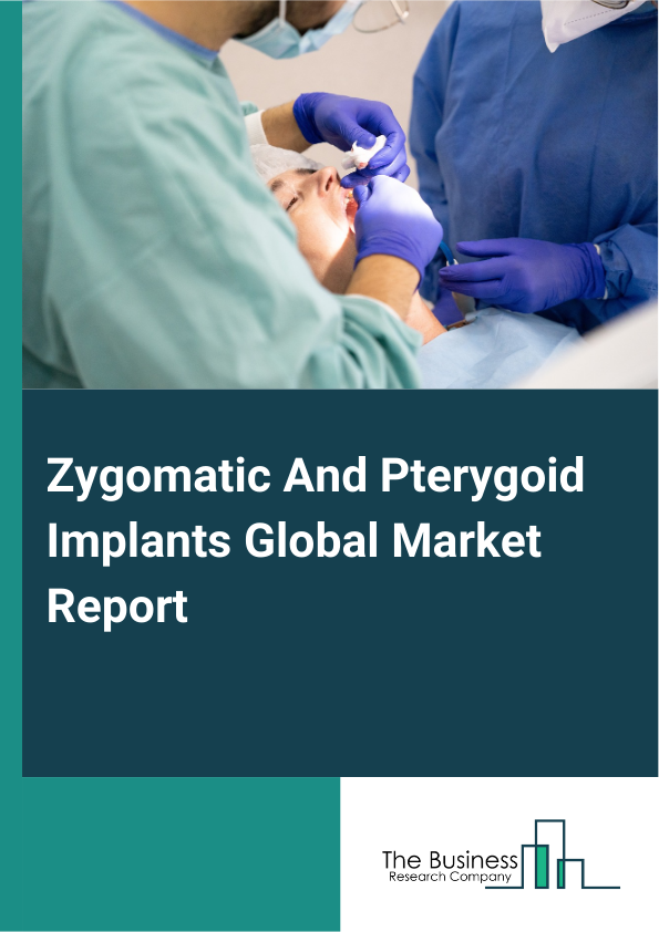 Zygomatic And Pterygoid Implants